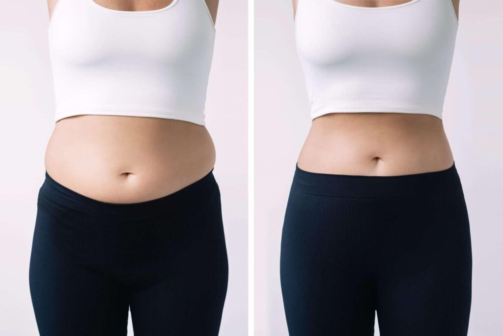 Dietician in Mumbai