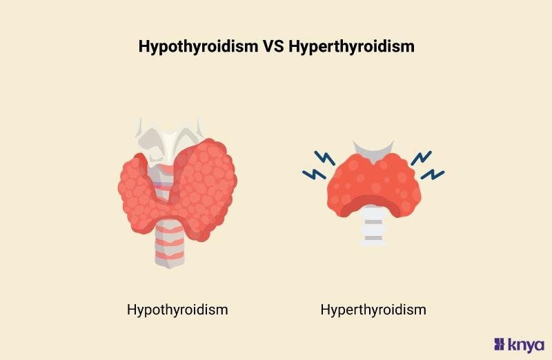 Thyroid Foods to Avoid: The Complete List of What Not to Eat Dietician in Mumbai
